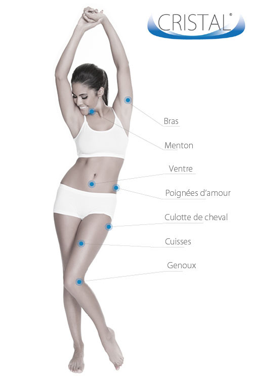 cryolipolyse zone traitées